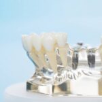 Implanty zębów ze Szczecina